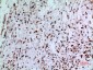 CD74 Polyclonal Antibody